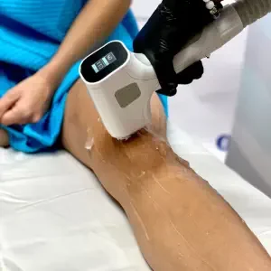 laser hair removal diode machine